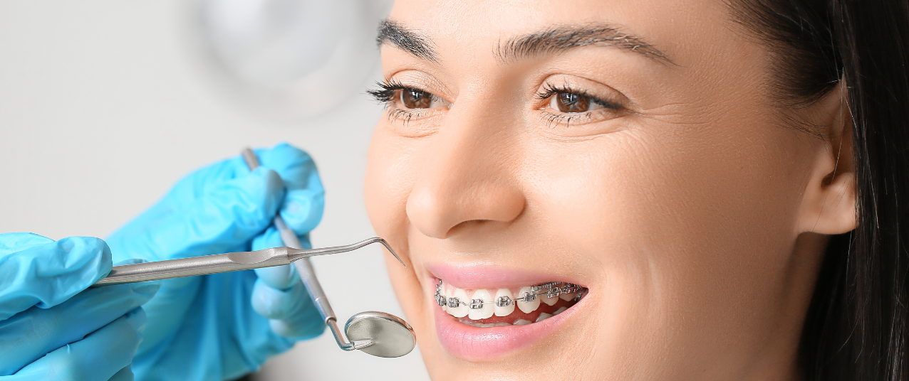 Orthodontics at Gentle Dental Smile – Invisalign and braces in Hanover Park IL