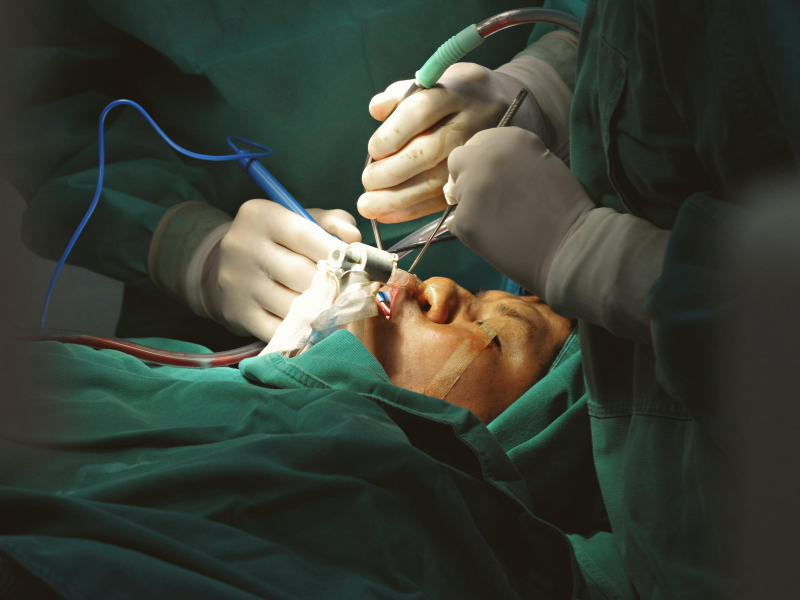 Experienced dental surgical team at Gentle Dental Smile Hanover Park IL