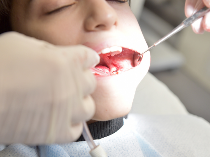 Experienced periodontal therapy team at Gentle Dental Smile Hanover Park IL