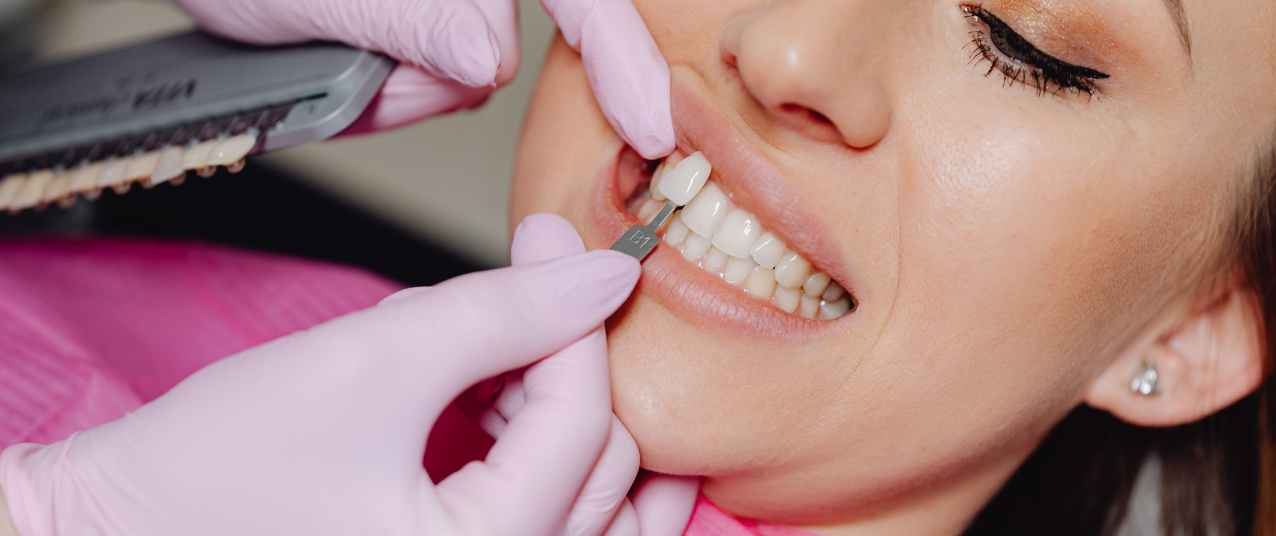 Cosmetic dentistry and smile makeover at Gentle Dental Smile – veneers and teeth whitening in Hanover Park IL